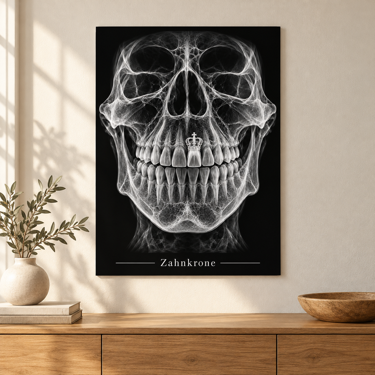 Zahnkrone – Anatomie-Poster ohne Rahmen