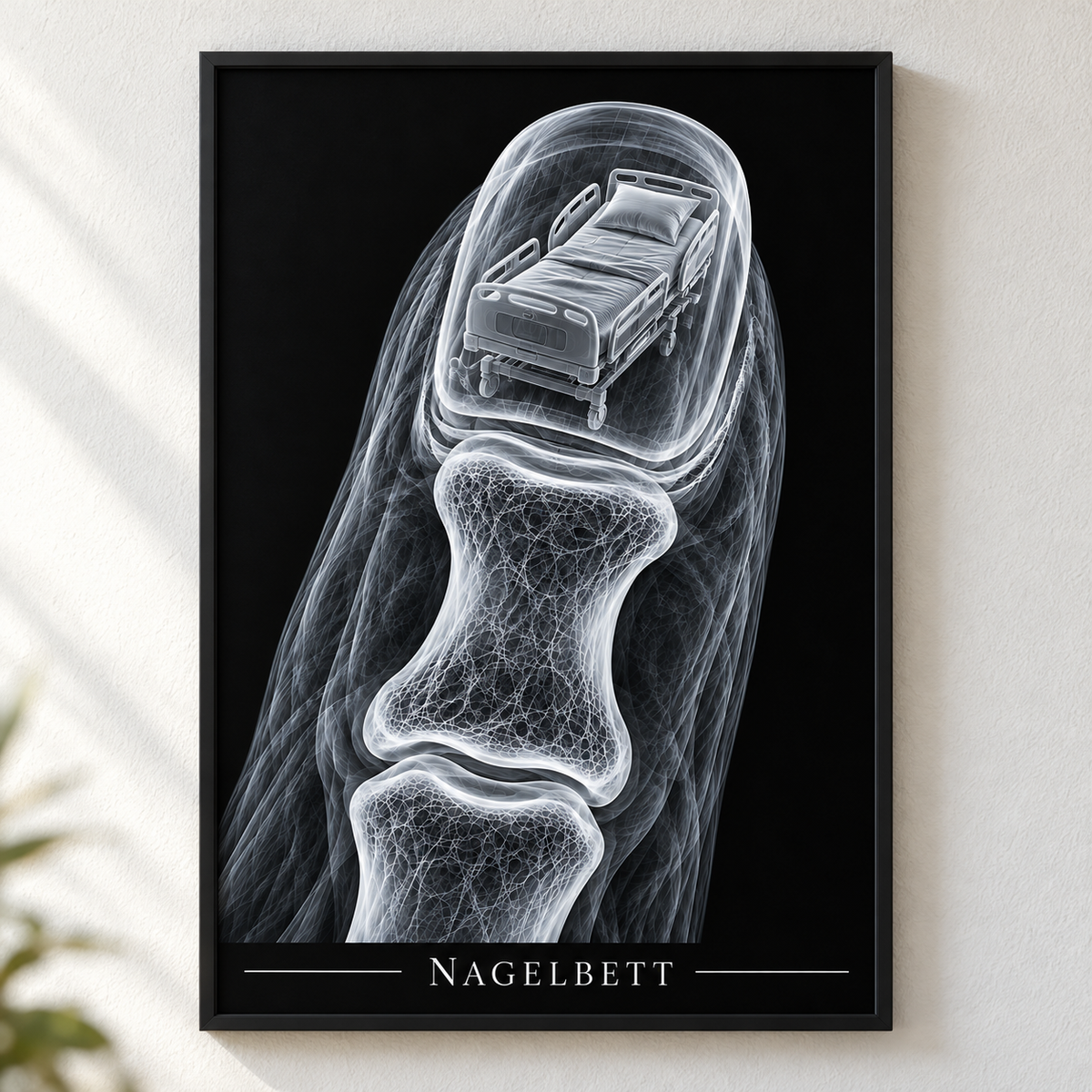 Nagelbett – Klinikbett – Poster mit schwarzem Rahmen